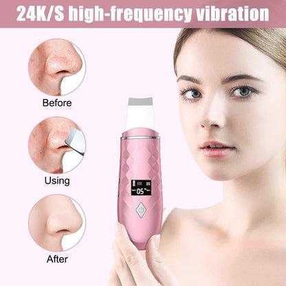 Ultrasonic Skin Scrubber & Pore Cleanser Device